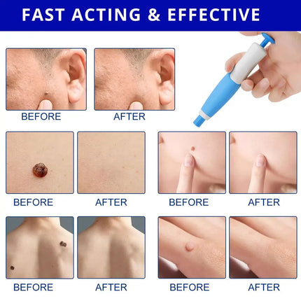 Double-Head Skin Care Pen