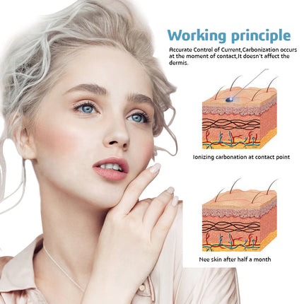 Professional Plasma Skin Care Pen